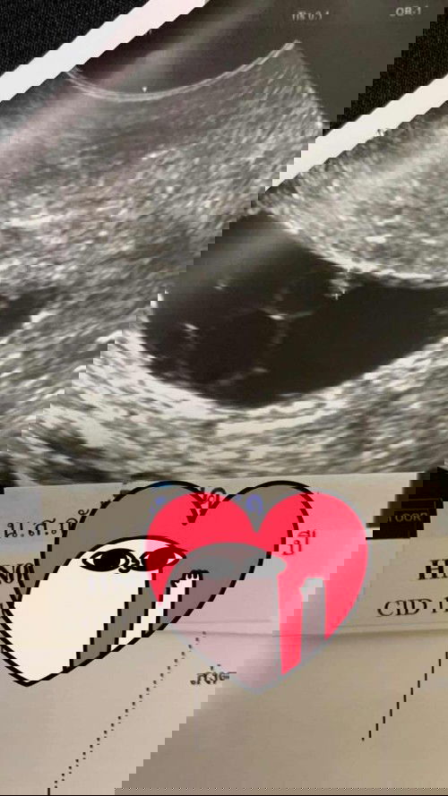 แม่ๆซาวด์เจอน้องตอนกี่วีคกันคะ?