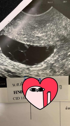 แม่ๆซาวด์เจอน้องตอนกี่วีคกันคะ?