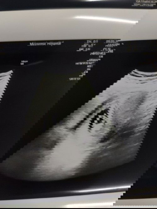 ซาวด์ 11W1D แบบนี้รู้เพศรึยัง??