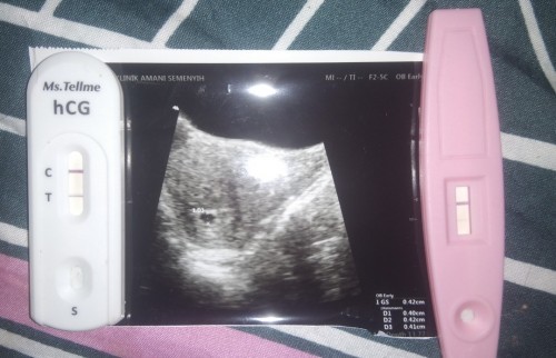 Pregnant balik after miscarriage