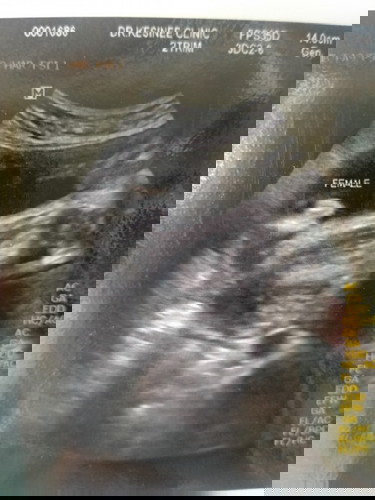 ถามเรื่องเพศ