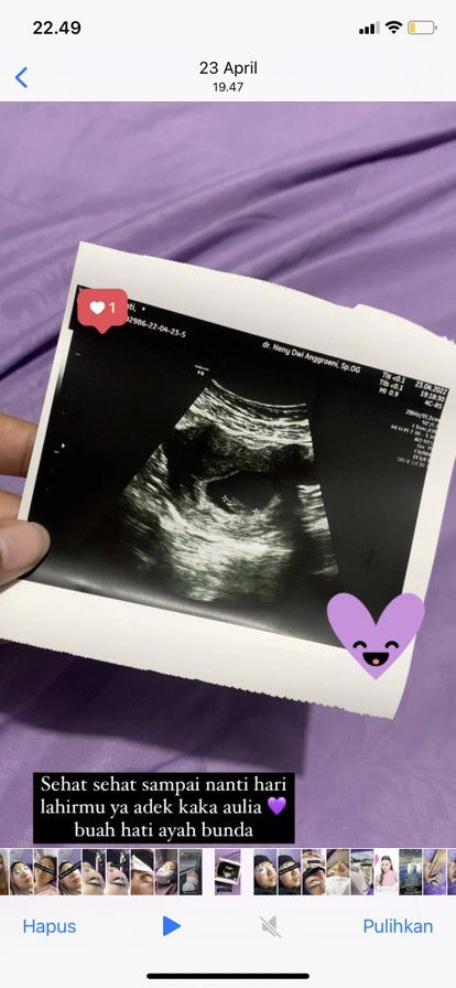 Apakah kemungkinan kembar