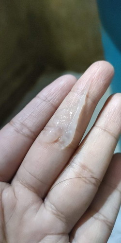 มีวุ่นใสๆออกมาจากช่องคลอด