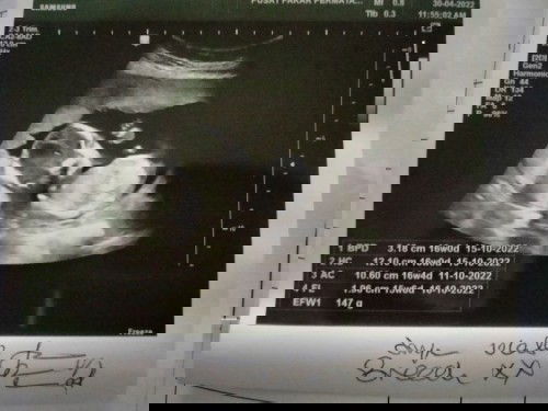 Nak tanya susu kambing dah boleh minum ke bila dah 17weeks... Susu kambing apa yg sesuai utk gdm?