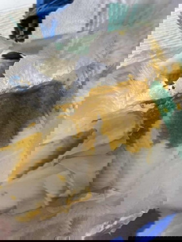 น้องถ่ายแบบนี้ปกติมั้ยคะ