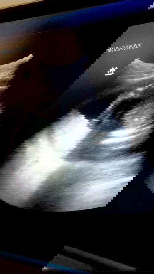 Bantu jawab ya bun
Soalnya hamil anak prtma