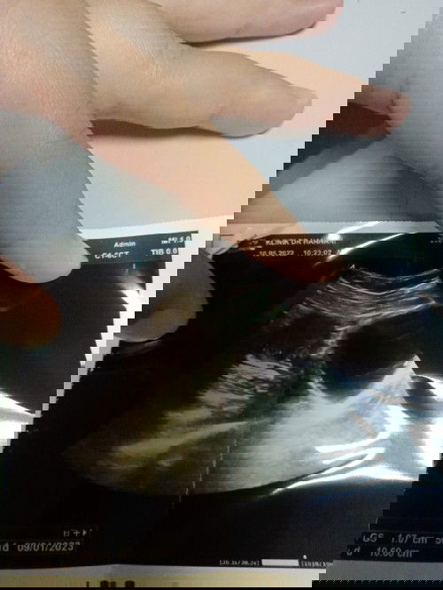 Macam mana nak bagi baby semakin membesar,, risau doc scan baby sepatutnya 7 minggu tapi ni scan 5mg