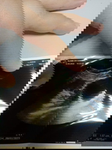 Macam mana nak bagi baby semakin membesar,, risau doc scan baby sepatutnya 7 minggu tapi ni scan 5mg