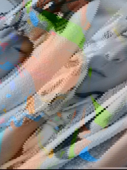 Anakku Sudah Bersama Nabi Ibrahim #Anencephaly