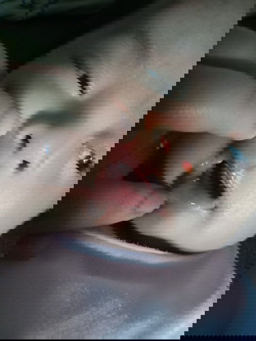 Bintik putih di bibir bayi