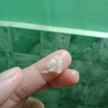 Discharge? or Mucus Plug?