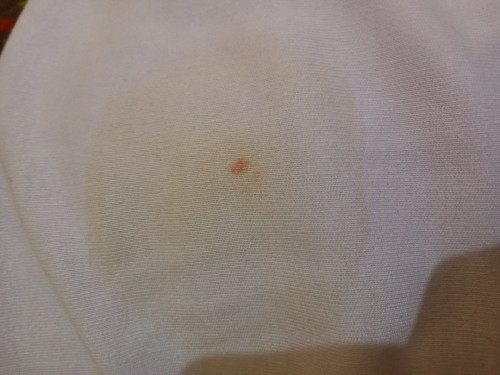 Ini pipis anak ku di popok nya kaya ada bercak merah gini, ada yg tau? Bayi ku umur 2mingguan