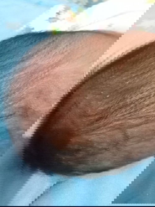 ลูกมีตุ่มสีเหลืองทั่วหัวกับที่หน้าอก