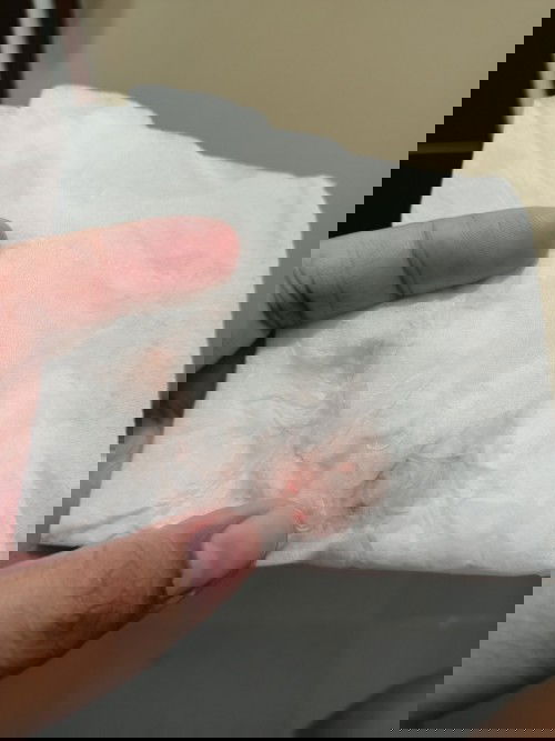 เลือดล้างหน้าเด็กใช่ไหม