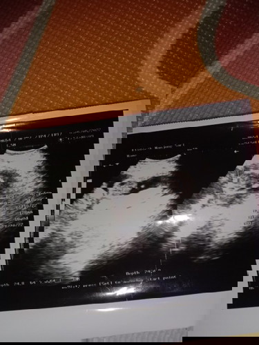 Kehamilan 18 wk