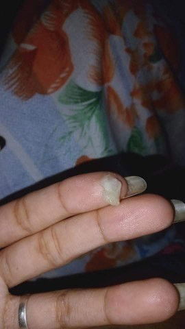 Normal lang po ba to??