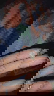 Normal lang po ba to??