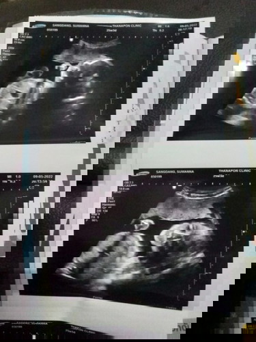 ลูกของแม่ๆแต่ล่ะบ้านมีน้ำหนักเท่าไหร่กันแล้วจ๊ะ