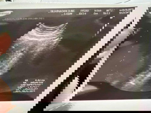 สรุปหนูเพิ่งได้ 5w2d นะคะแม่ๆ 👼🏻