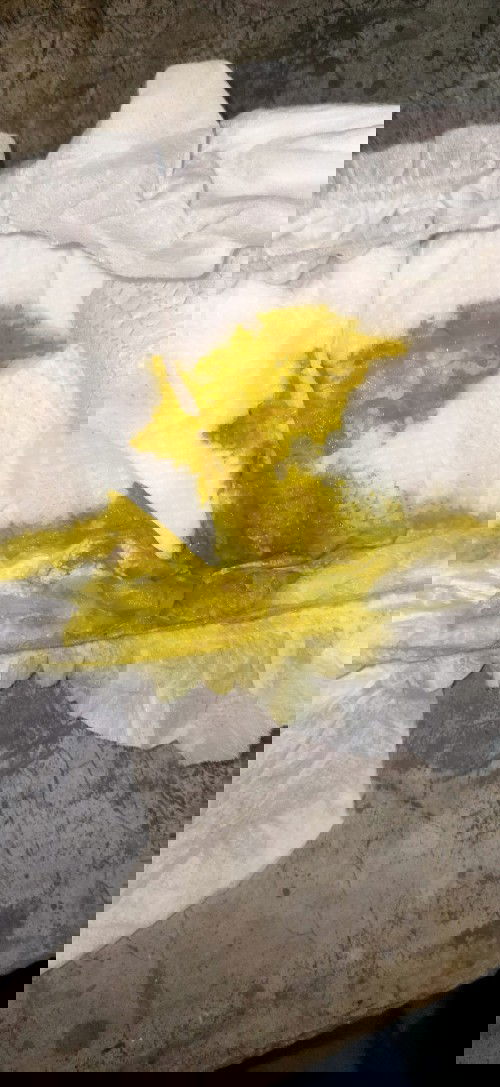 Normal poop po ba ito