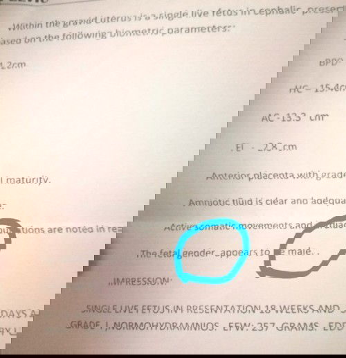 Meron po ba dtong 18 weeks palng nlman na gender ni bby n boy peo sbe eh di pa sure?