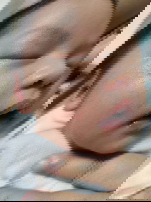 Nga mommies ano po to sa baby. T ano po gamot na cream para dito