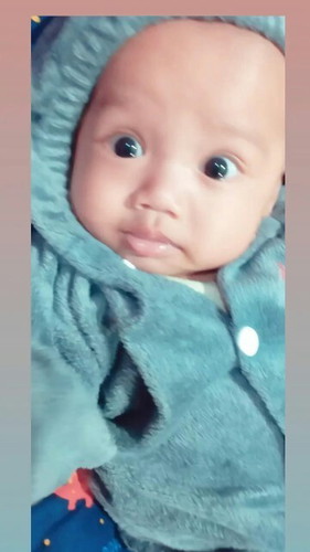 Bayi 5 bulan blum kluar air mata