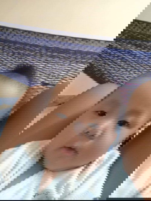 เป็นไรคะ แม่ว่าจะไปถามหมอตอนไปฉีดวัคซีน