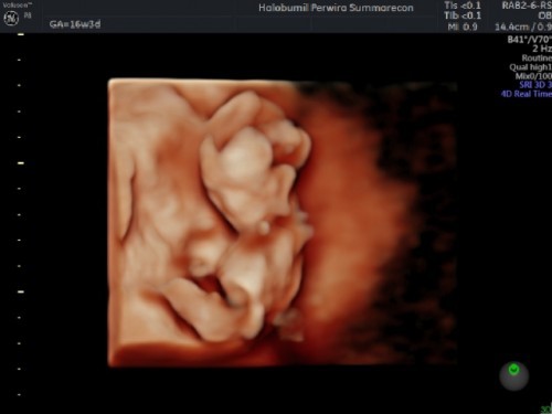 USG jenis kelamin 4D 16 minggu