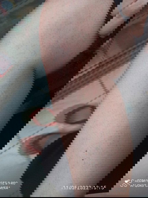 Bintik merah seluruh badan