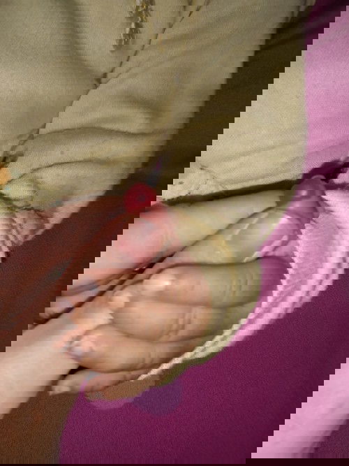 Jari jempol tangan merah melendung