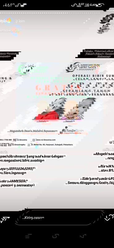 OPERASI BIBIR SUMBING