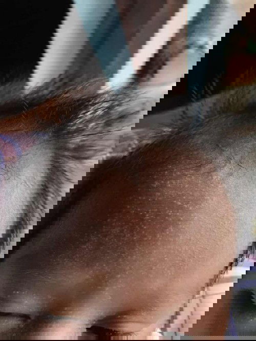 Bintik bintik di kepala