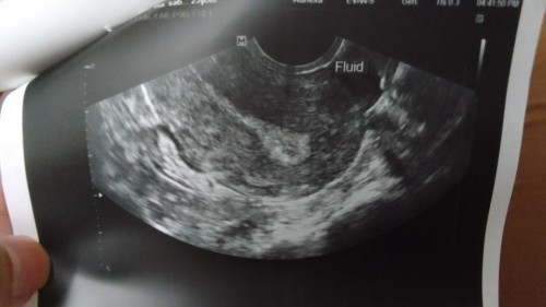 Pregnancy Test Questions