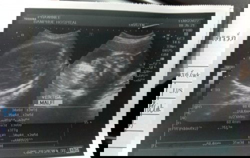 ทีมมิถุนายน 65