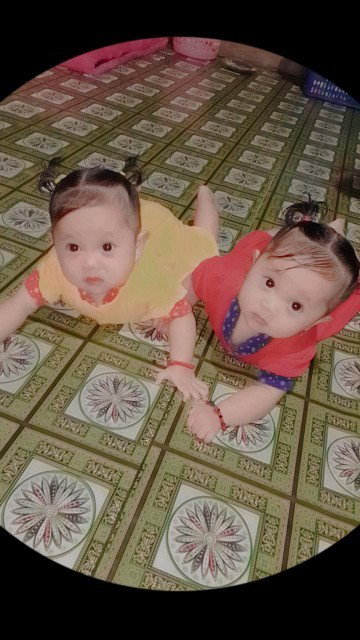 Babytwins 7bulan 7hari