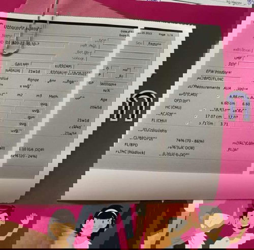 แม่ท้องอ้วนมากหมอบอกซาวน์ดูความผิดปกติของลูกไม่ได้