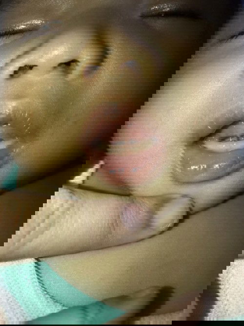 Lip tie and tie Tounge baby