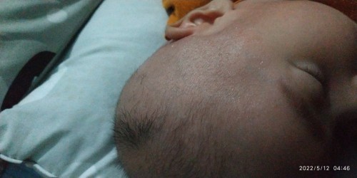 2bulan gampang berkeringat