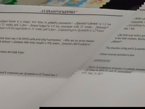 It's a Baby Girl! ❤️