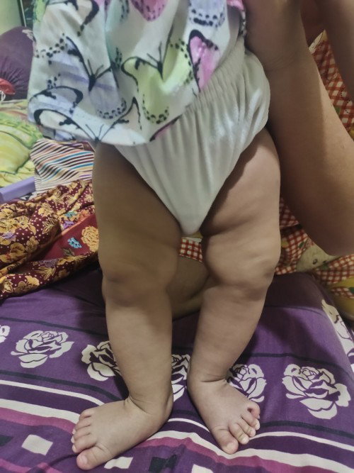 Kaki bayi miring sebelah