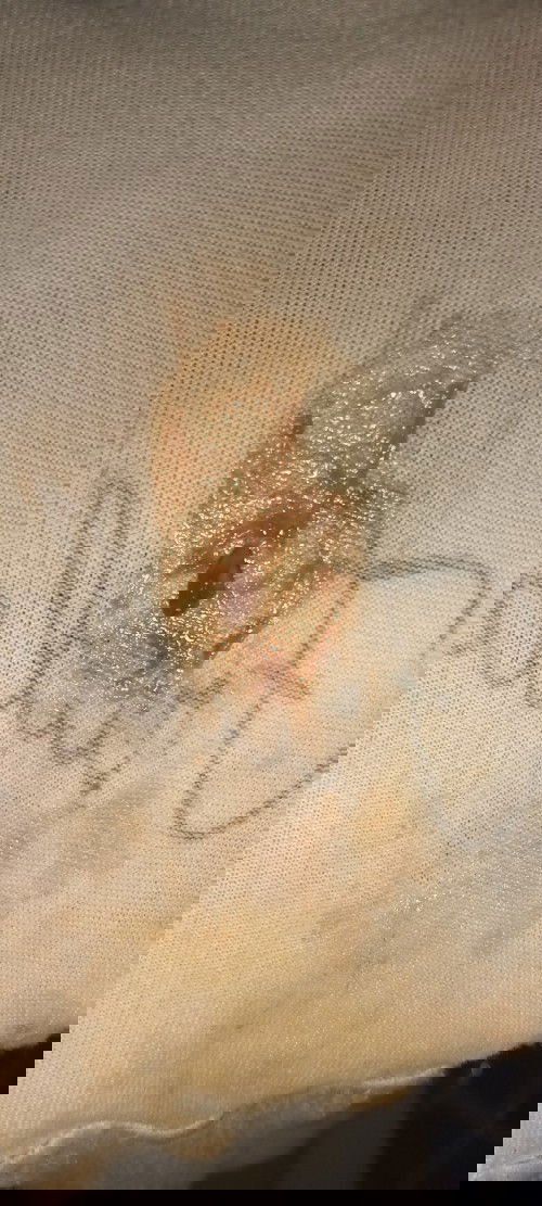 Keluar lendir coklat, 40 Minggu 4 hr