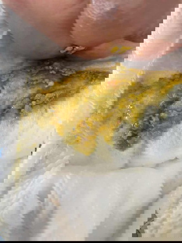 ทารกถ่ายมีเลือดปนมานิดหน่อย