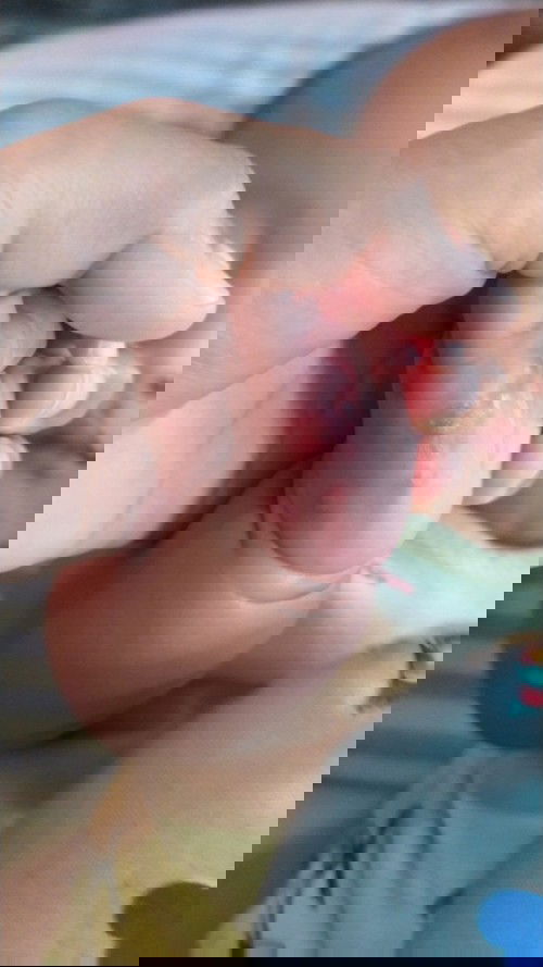 Bentol2  kyak berair