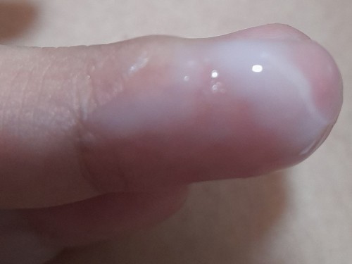 Hi nak tnya kalau keputihan color ni petanda nak period atau pregnant?