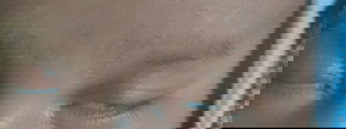 seperti kulit kering disekitar alis mata