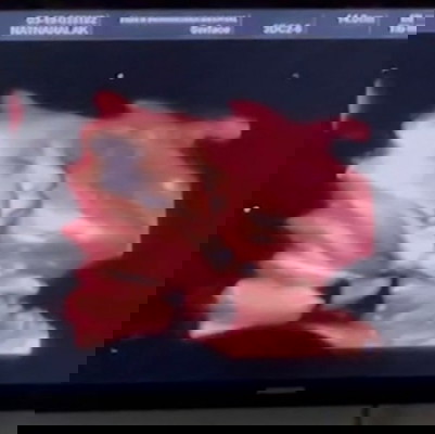 ใกล้เจอหน้ากันแล้วนะเบบี้