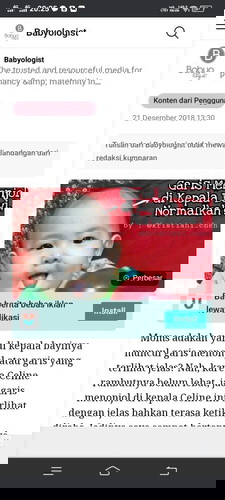 Bentuk kepala bayi melingkar seperti bando