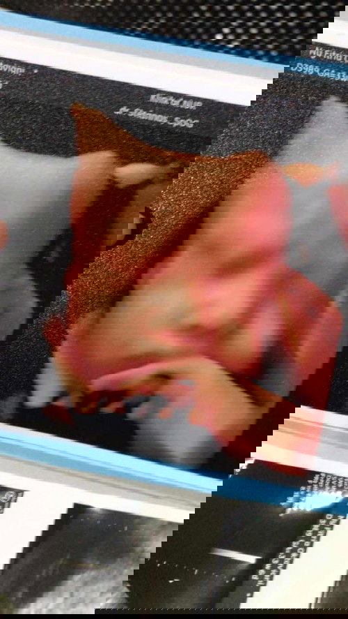 34 week gerakan janin