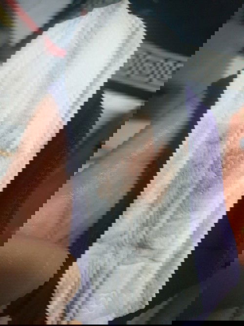 IMPLANTATION BLEEDING